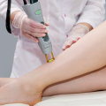 Is Laser Hair Removal Safe and What Are Its Side Effects?