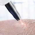 Can I Take Vitamin D Before Laser Hair Removal? - A Guide to Pre- and Post-Treatment Precautions