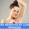 Who Benefits Most From Laser Hair Removal?