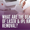 Life-Changing Benefits of Laser Hair Removal