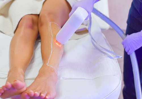 The Dangers of Laser Hair Removal: What You Need to Know