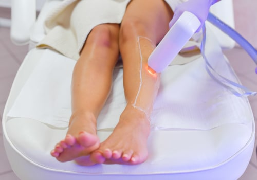 How Long Does Laser Hair Removal Last? Expert Advice on Lasting Results