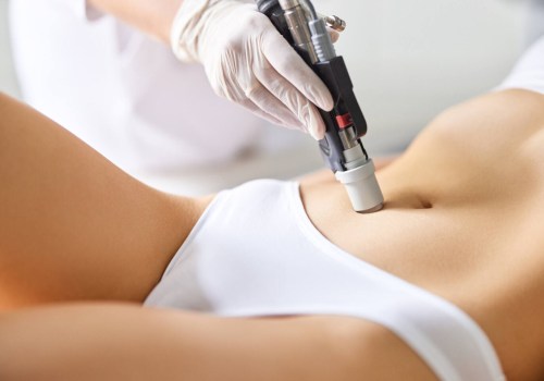 What is the Recovery Time After a Laser Hair Removal Treatment?