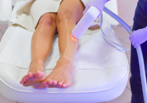 Is Laser Hair Removal the Right Choice for You?