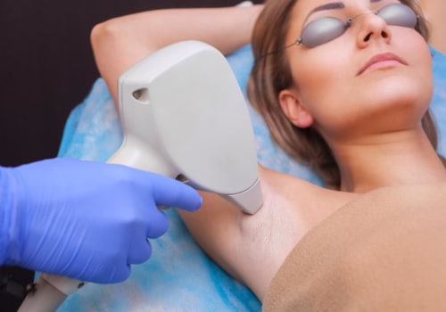 Is Laser Hair Removal Safe? Long-Term Effects Explained