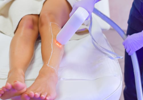 Is Laser Hair Removal Safe? Risks and Benefits of the Treatment